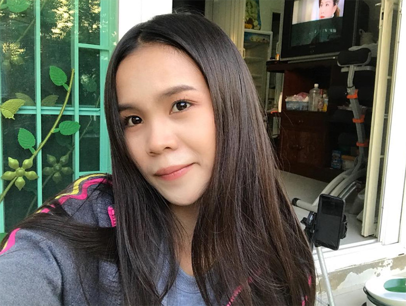 อาม ชุติมา ศัลยกรรมอะไรมาบ้าง เปิดภาพหน้าเก่า VS หน้าใหม่