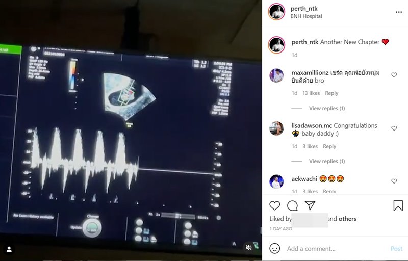 เตย เพิร์ท