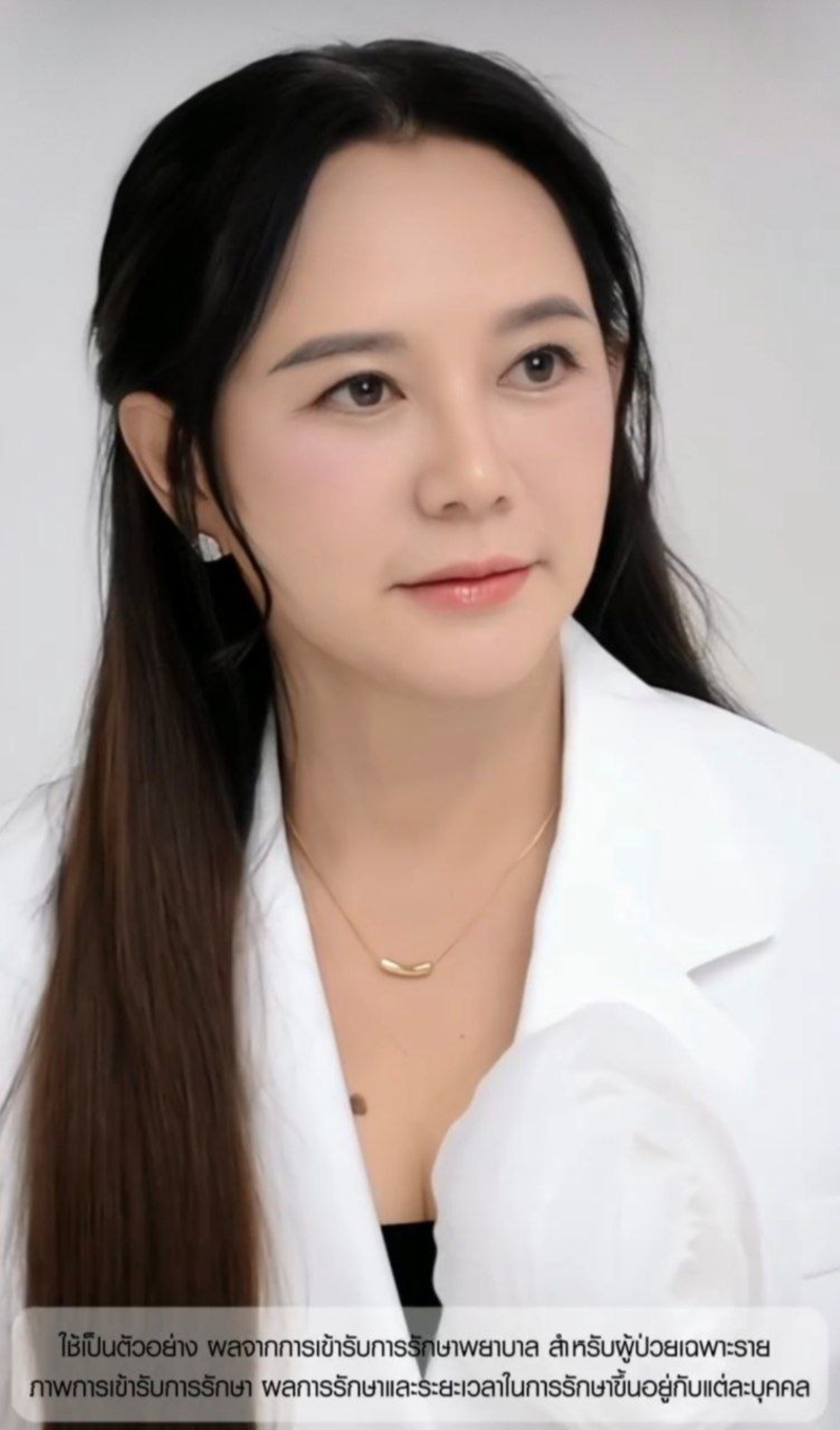 ภาพ แหม่ม จินตหรา ล่าสุด หลังทำศัลยกรรมในวัย 60