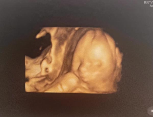 ไอซ์ อภิษฎา