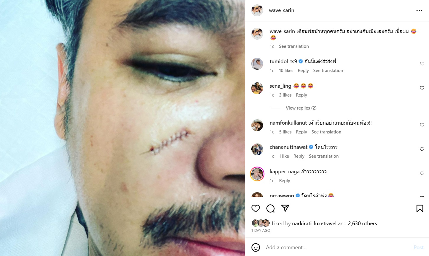 เวฟ วิภพ, บุ้ง สะธี