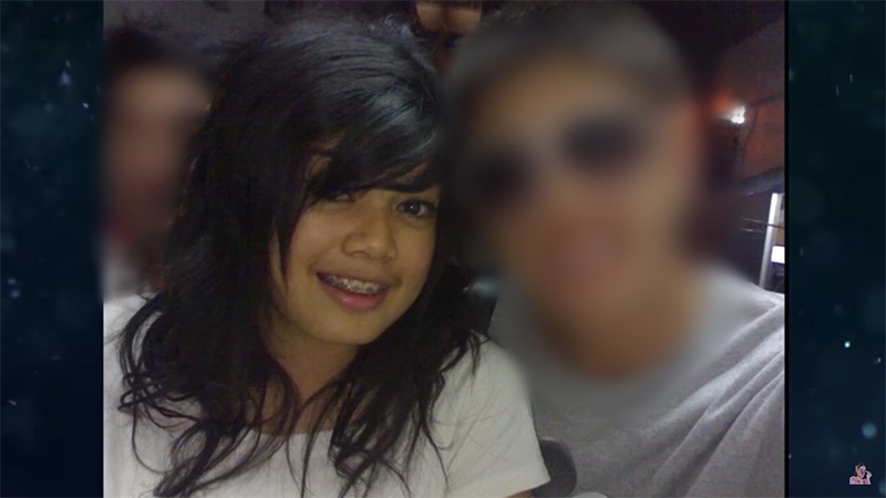 พิมรี่พาย ศัลยกรรม