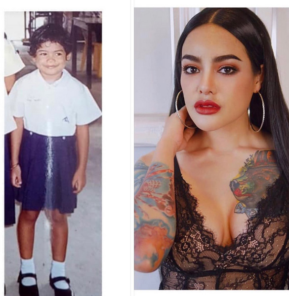 พิมรี่พาย ศัลยกรรม