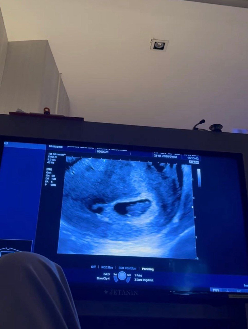 หมออร ประกาศท้องแล้ว เกรท วรินทร