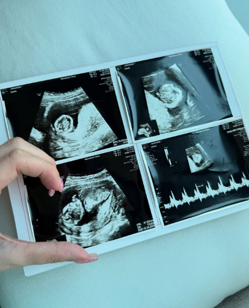 เปิดประวัติ บีเบล ไอยา ยูทูบเบอร์สาวล้านซับ คุณแม่เลี้ยงเดี่ยวสุดสตรอง