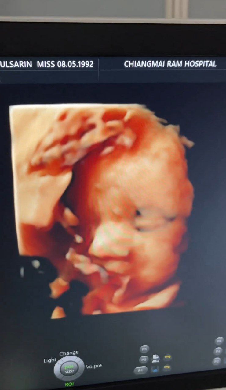 หญิง ธนัจจิญญา