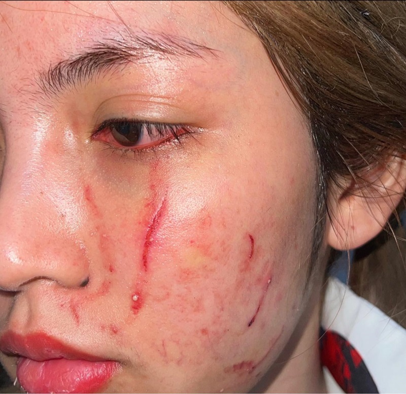 โนอา ภญมณ