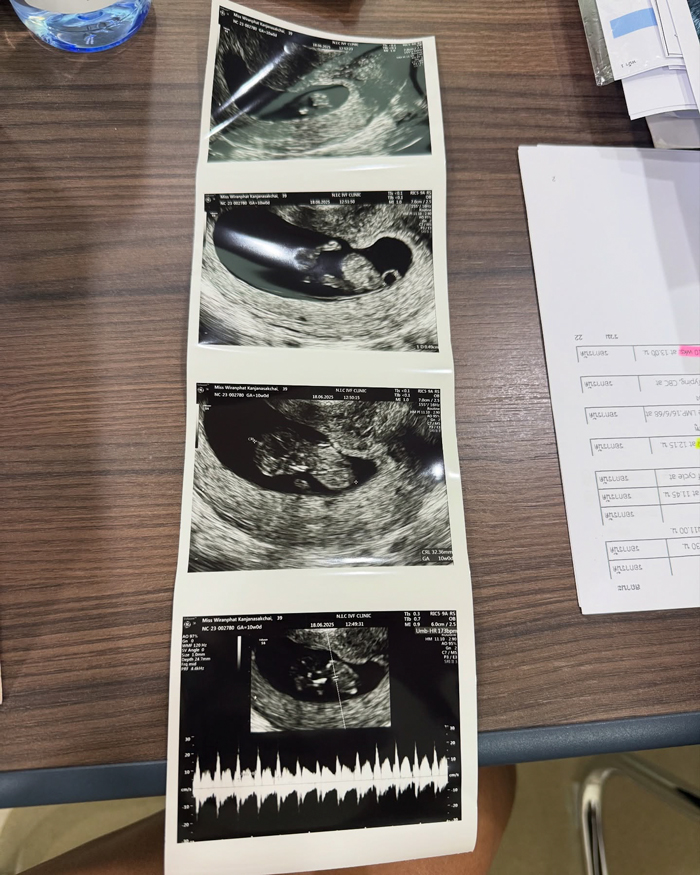 ปาย สิตางศ์ ท้อง