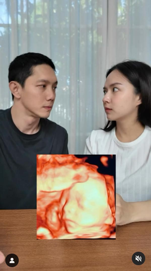 ใบเตย ปั๊บ ภาพอัลตราซาวด์ลูก