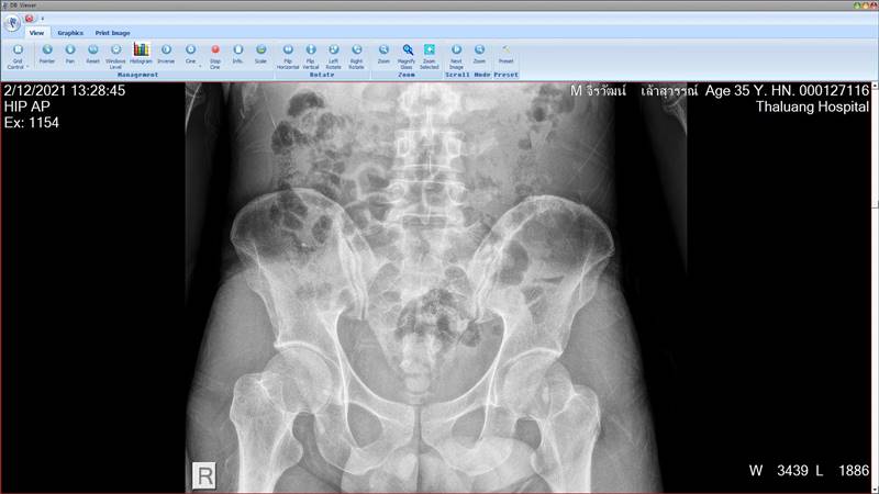 น้องฟ้า ถูกทำร้าย