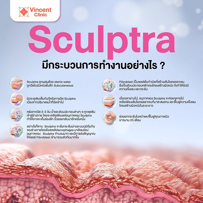 Sculptra คืออะไร ช่วยเรื่องอะไร เหมาะกับใคร ต่างจากวิธีอื่นไหม ?