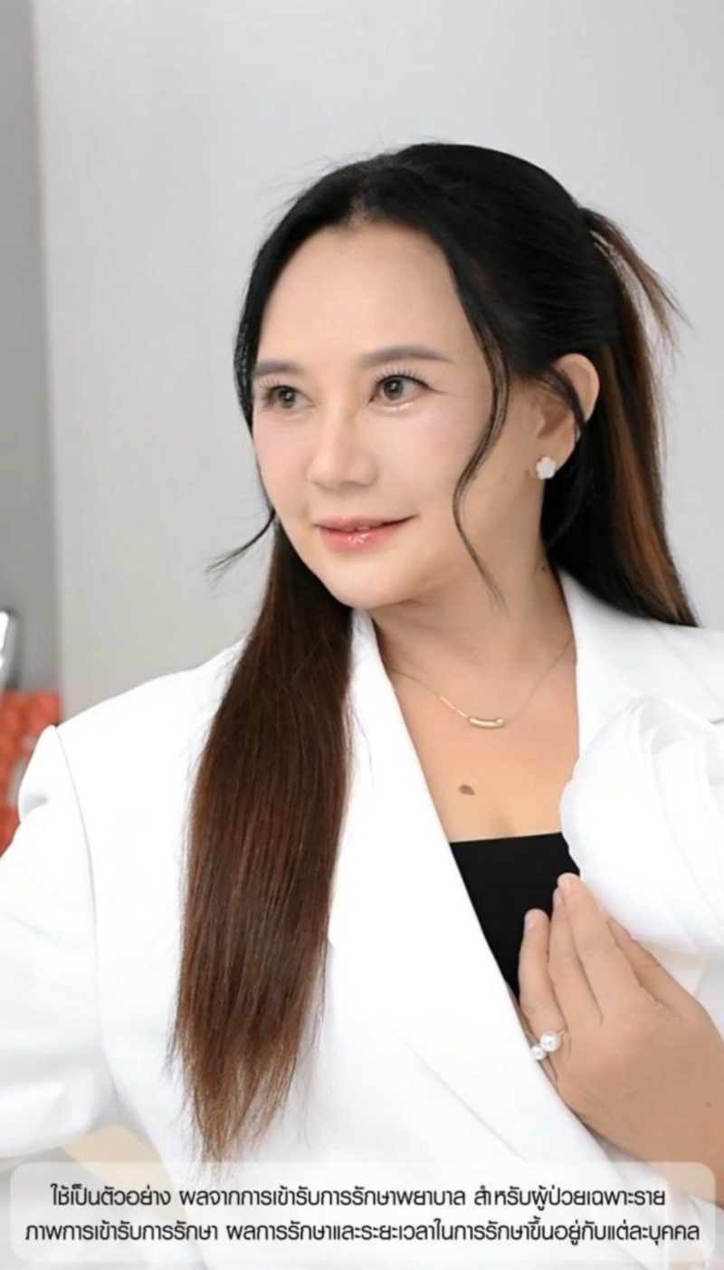 ภาพ แหม่ม จินตหรา ล่าสุด หลังทำศัลยกรรมในวัย 60