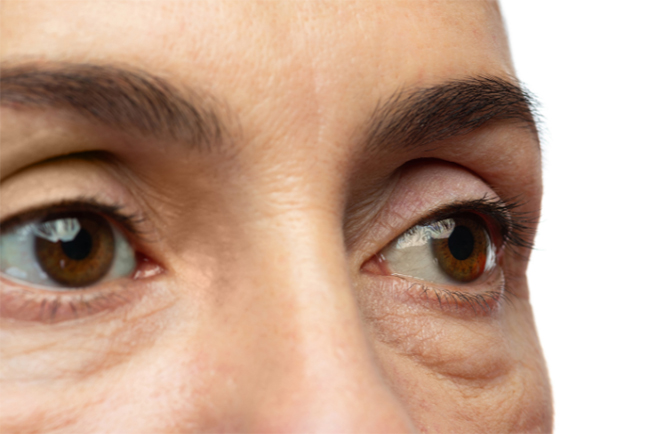 ถุงใตัตา