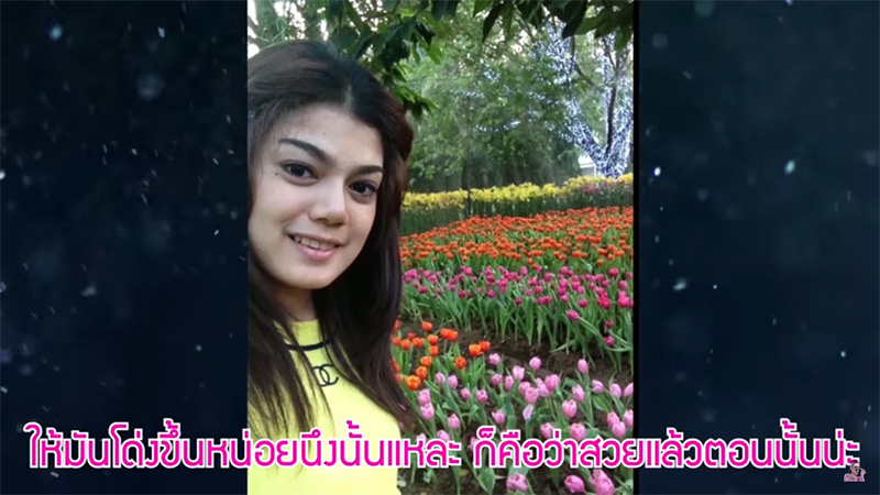 พิมรี่พาย ศัลยกรรม