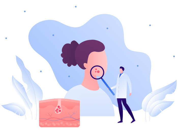 ทามอยเจอไรเซอร์แล้วแสบหน้า