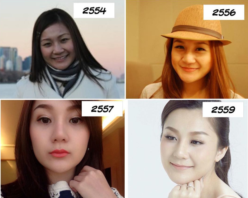 เอ็ม บุษราคัม ดาราศัลยกรรม