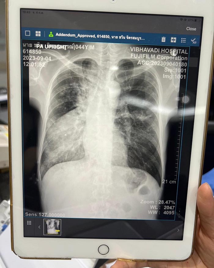 จั๊ก ชวิน