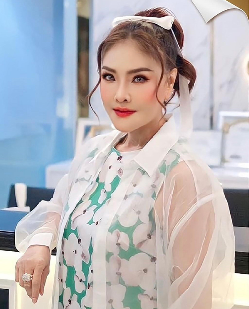 ดาว มยุรี ดาราศัลยกรรม