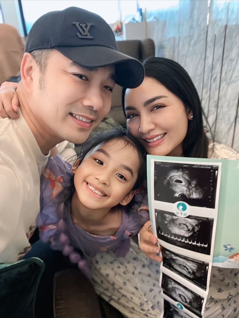 ครูก้อย ภรรยาเจมส์ เรืองศักดิ์ เย็บปากมดลูก ป้องกันคลอดก่อนกำหนด