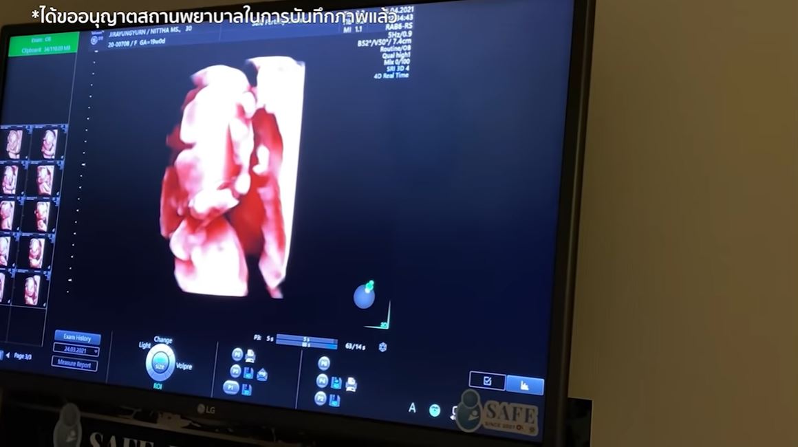 มิว นิษฐา 