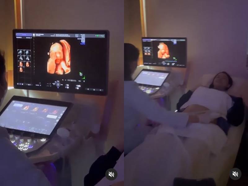 แพทริเซีย โน้ต เผยโฉมลูกครั้งแรก