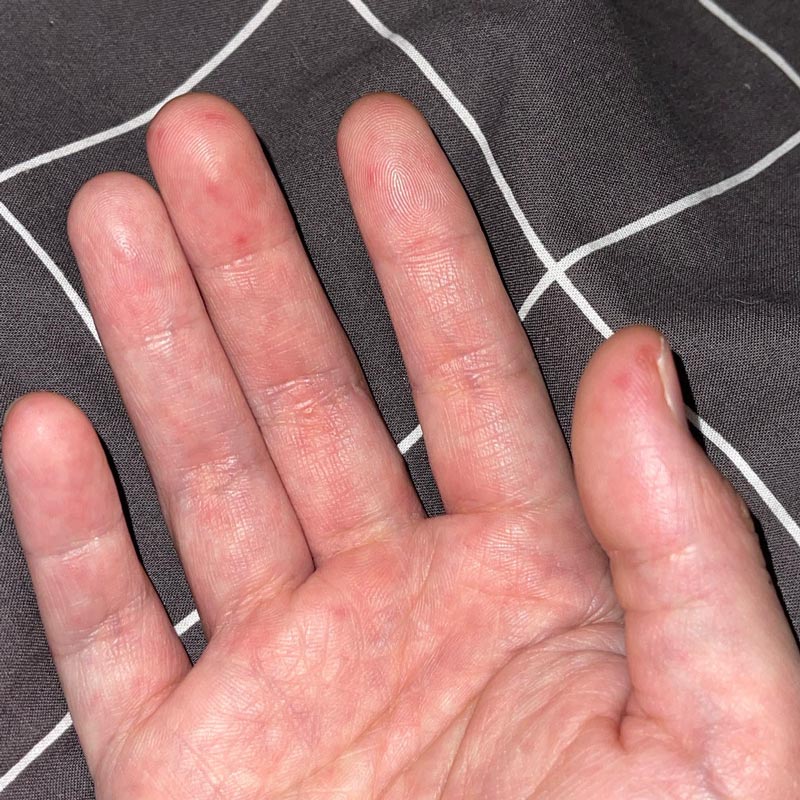 แต๊งค์ พงศกร ป่วย