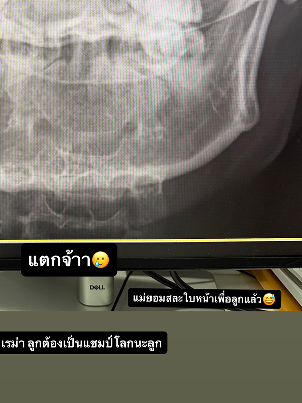 แนท ณัฐชา