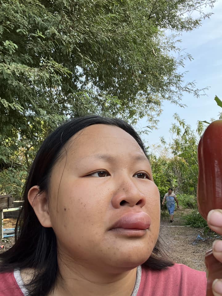 เก็บชมพู่