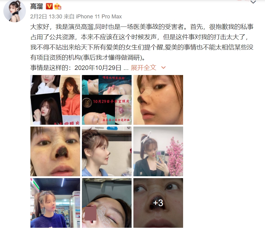 เกา หลิว (Gao Liu)