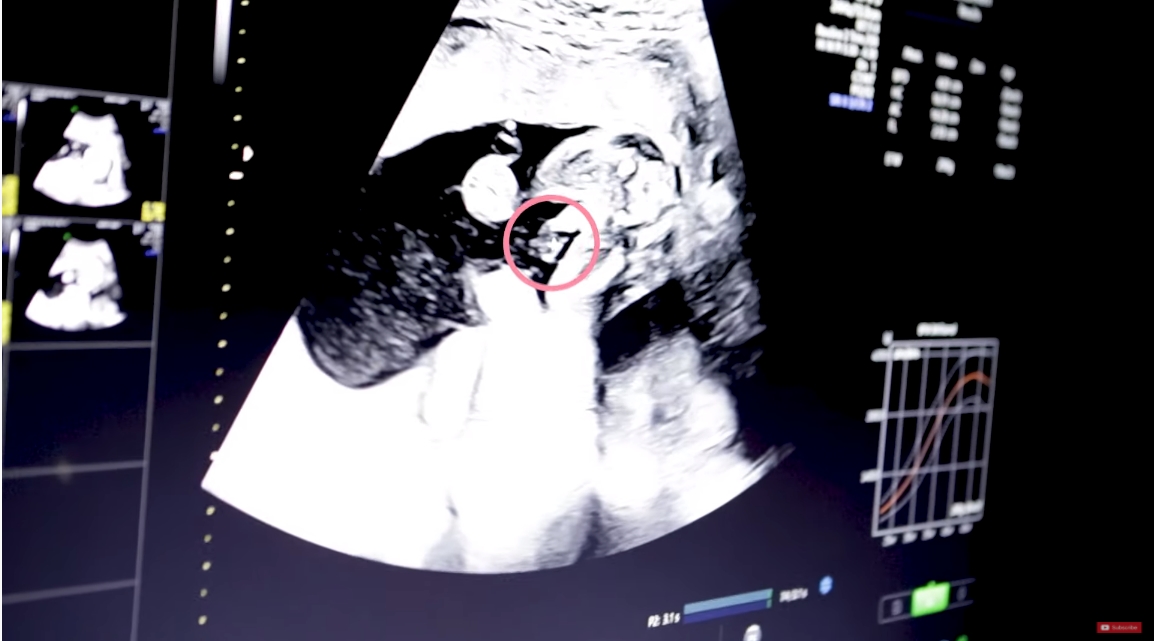  ตูน บอดี้สแลม ก้อย รัชวิน