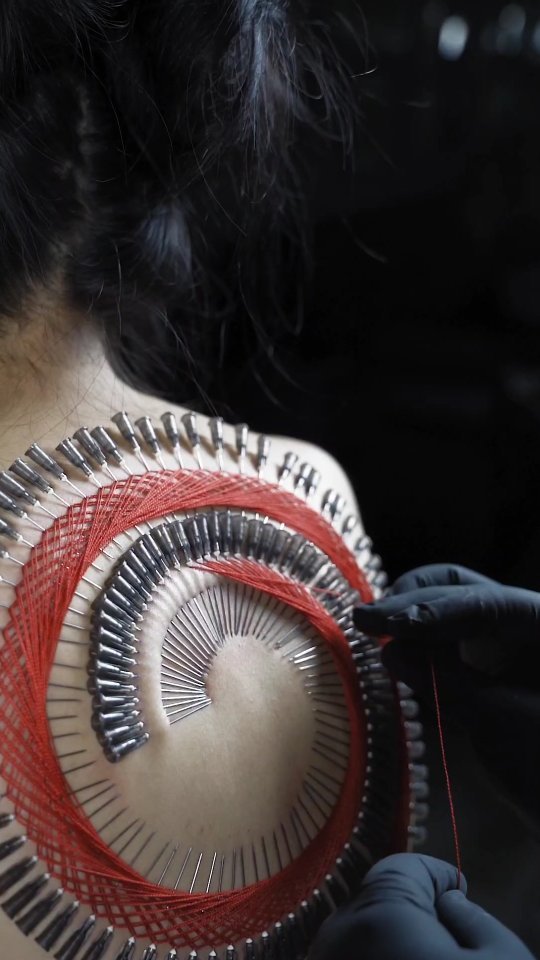 ศิลปะการฝังเข็ม