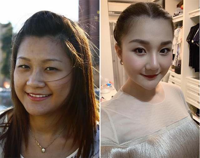 เอ็ม บุษราคัม ดาราศัลยกรรม