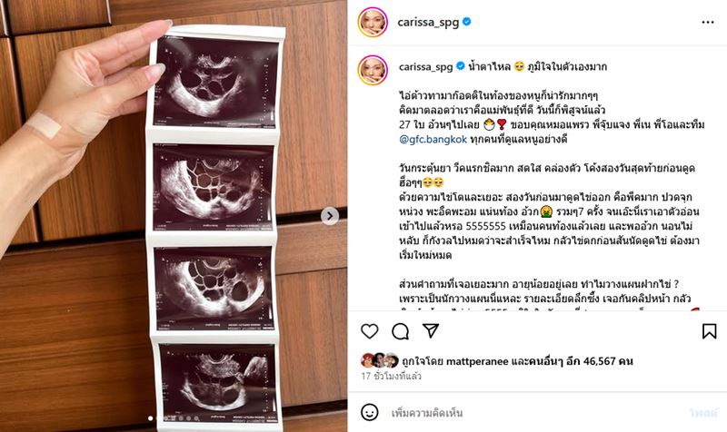 คารีสา ฝากไข่ 