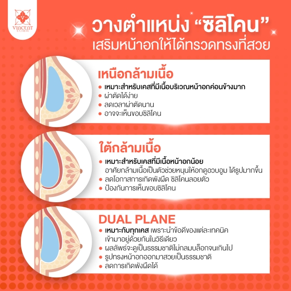 เสริมหน้าอก