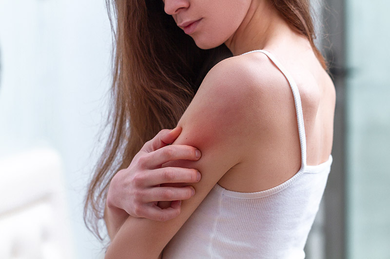 ผิวแพ้ง่าย