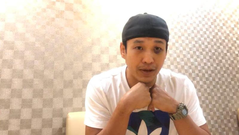 เอ็กซ์ ธิตินันท์