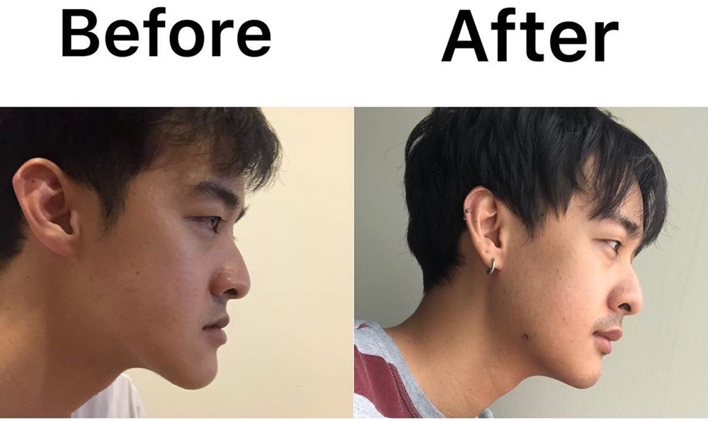 หม่อมเอ็ม อรรถพล