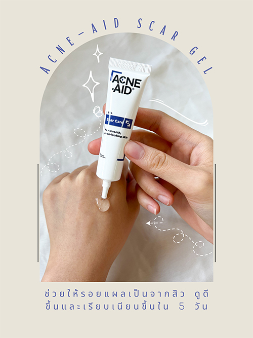 เจลแต้มสิวอุดตัน สลายสิวตรงจุด