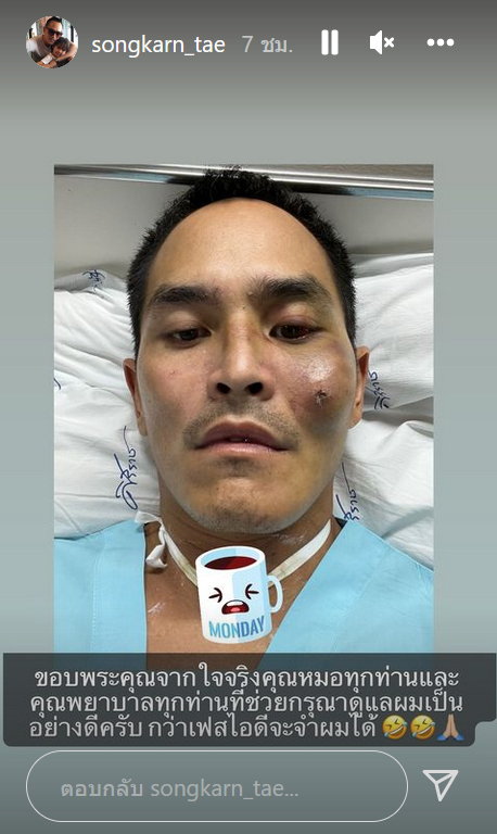 สงกรานต์ เตชะณรงค์