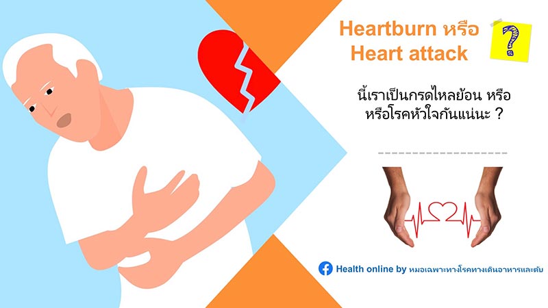เจ็บหน้าอก