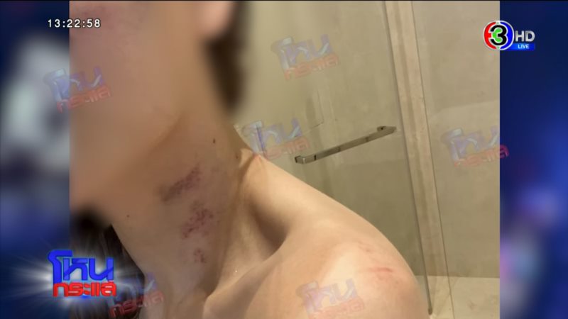 ไผ่ ลิกค์ ดิว อริสรา ถูกทำร้าย