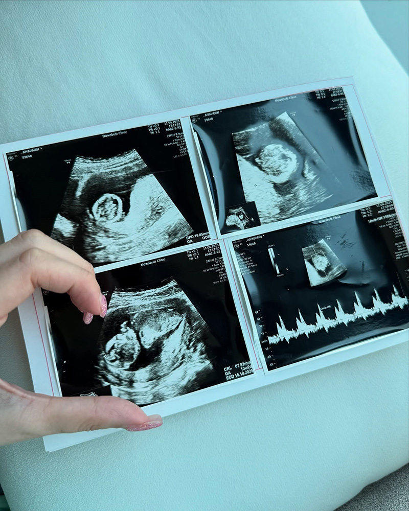 บีเบล เปิดใจหลังประกาศเป็นแม่เลี้ยงเดี่ยว