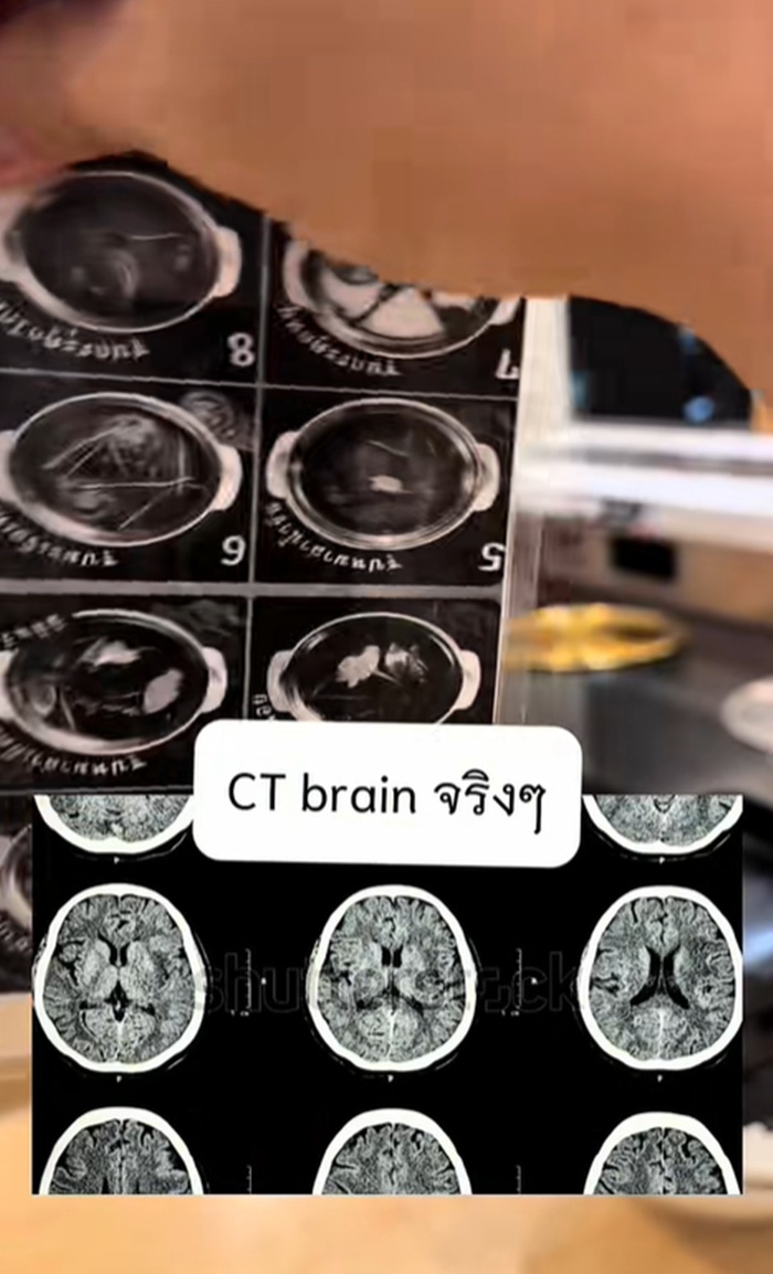 ซีทีสแกน