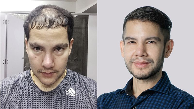 HERRMETTO Pro