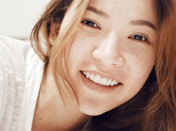 ต้นหอม ศกุนตลา ดาราศัลยกรรม