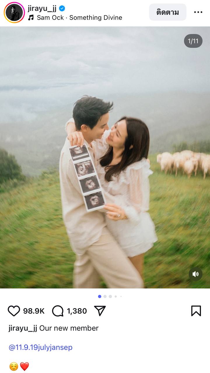 เจมส์ จิรายุ อวดภาพอัลตราซาวด์ ประกาศข่าวดีรับวันแม่ ภรรยาท้องแล้ว