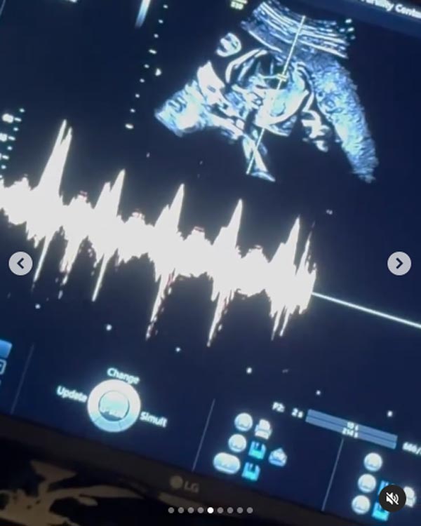 มิว นิษฐา ท้องลูกคนที่ 2