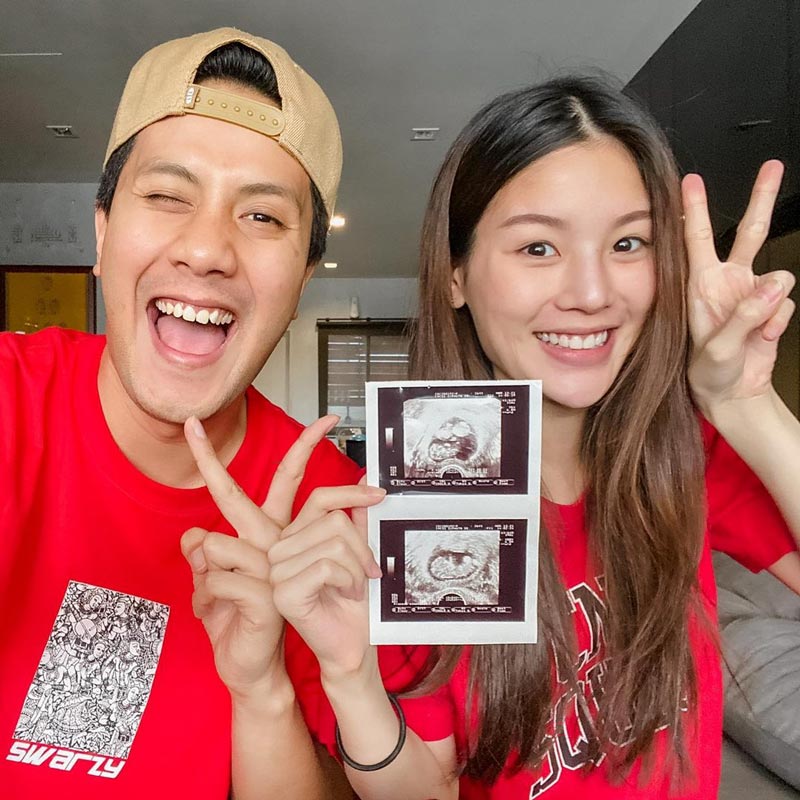 เป้ วงมายด์