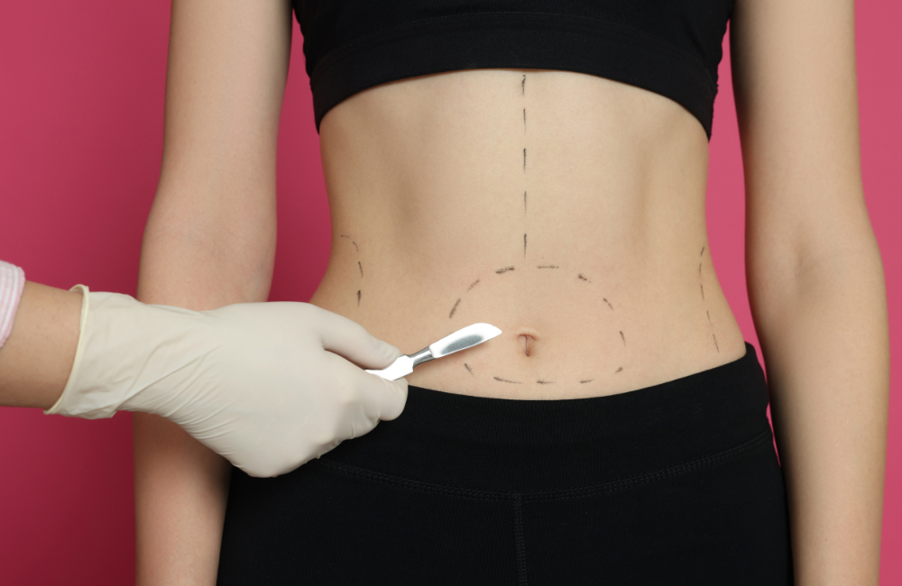 โปรแกรมดูดไขมันทำบริเวณไหน