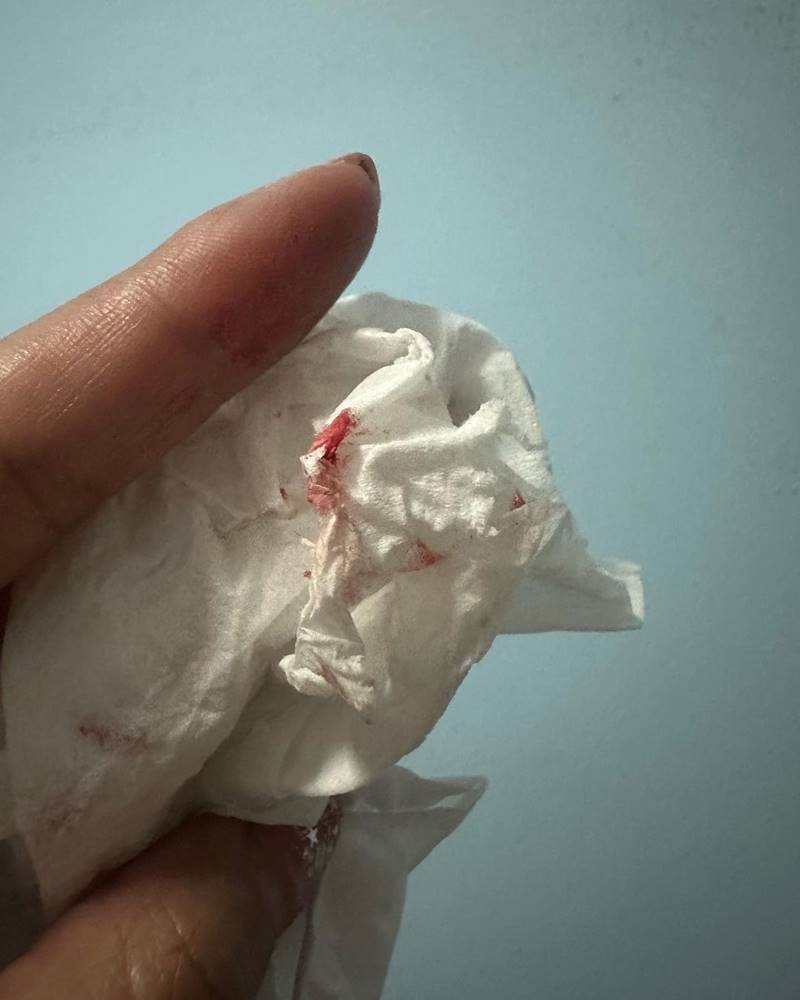 ลาล่า อาร์สยาม, ฝุ่น PM2.5